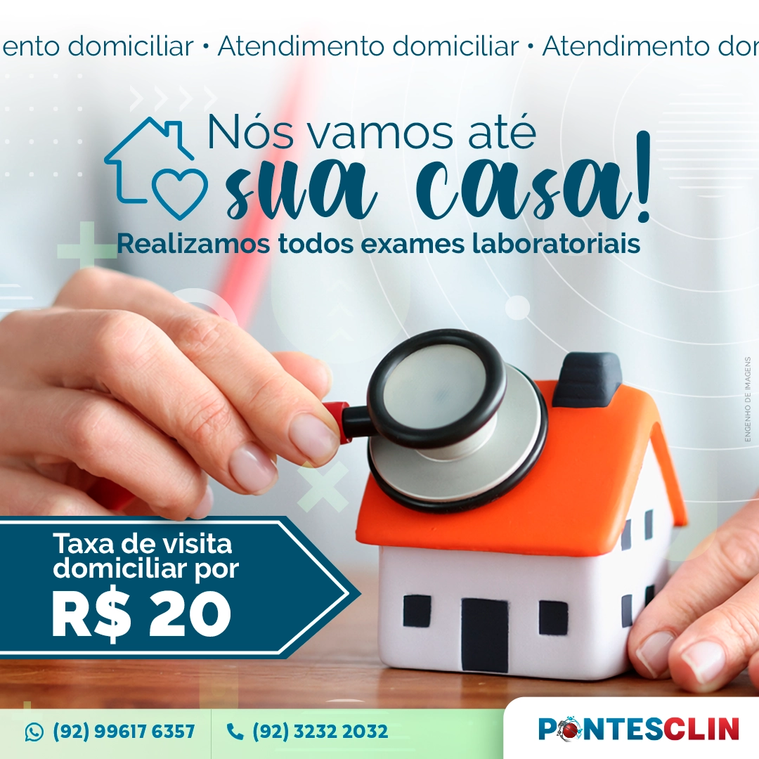 Nós vamos até sua casa