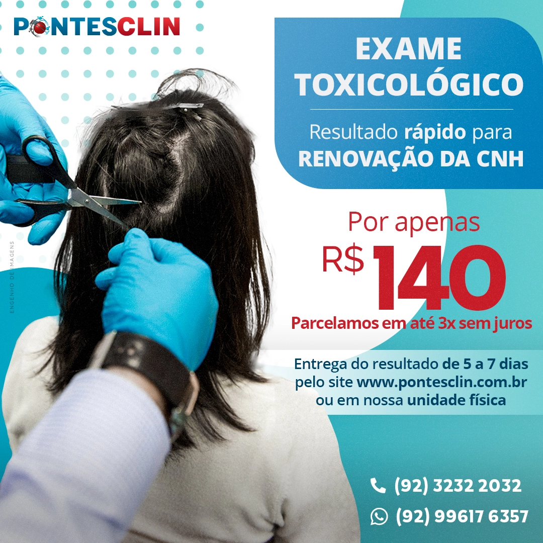 O EXAME TOXICOLÓGICO é INDISPENSÁVEL para você que precisa RENOVAR a sua CNH.