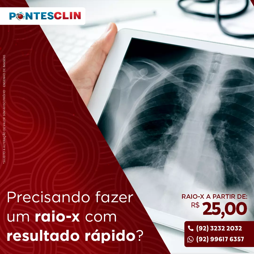 Precisando fazer um raio x com resultado rápido?